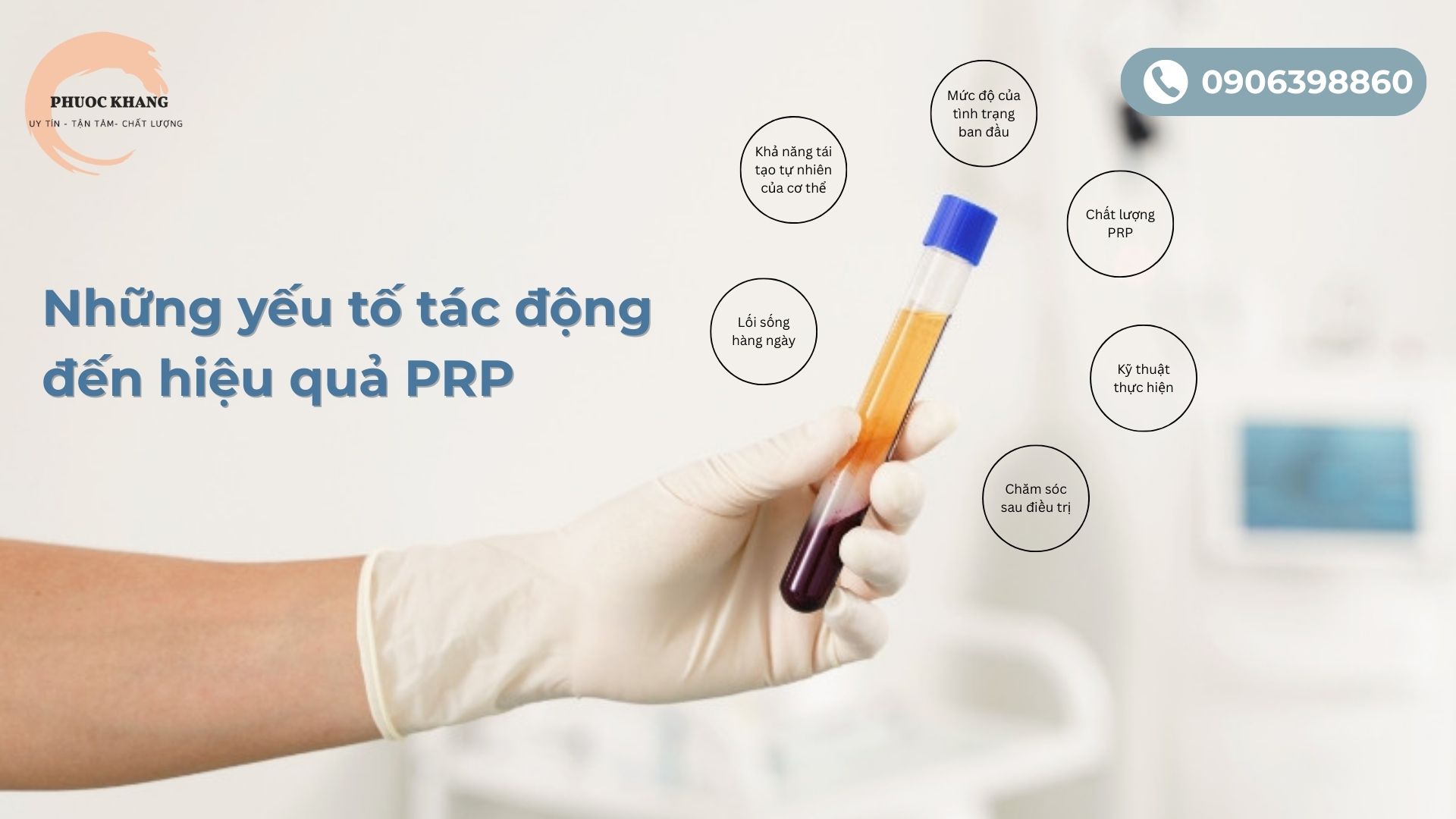 Những yếu tố tác động đến hiệu quả PRP