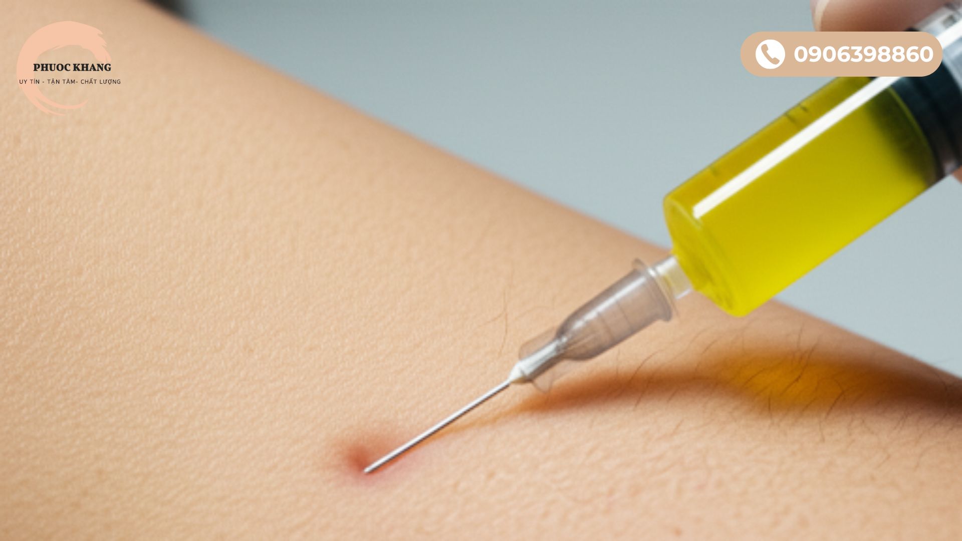 Tiêm PRP nhiều trong một lần hay tiêm nhiều lần?