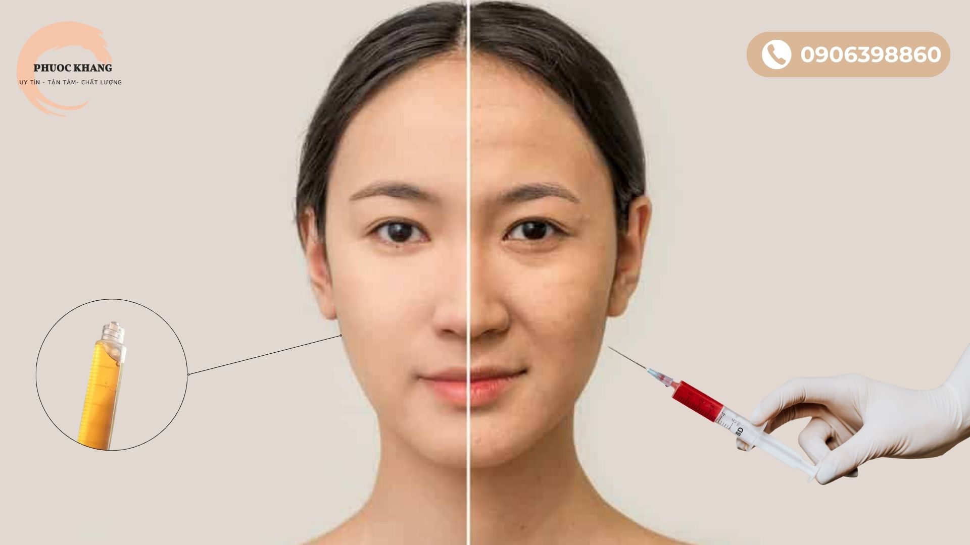 Khi da xuất hiện dấu hiệu lão hóa là lúc nên làm liệu trình PRP tiếp theo