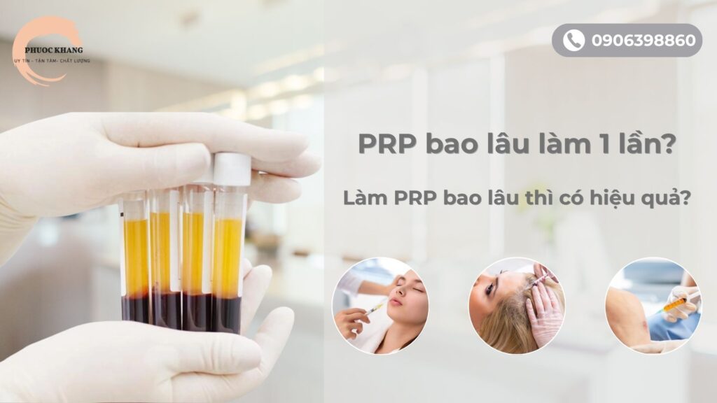 PRP bao lâu làm 1 lần?