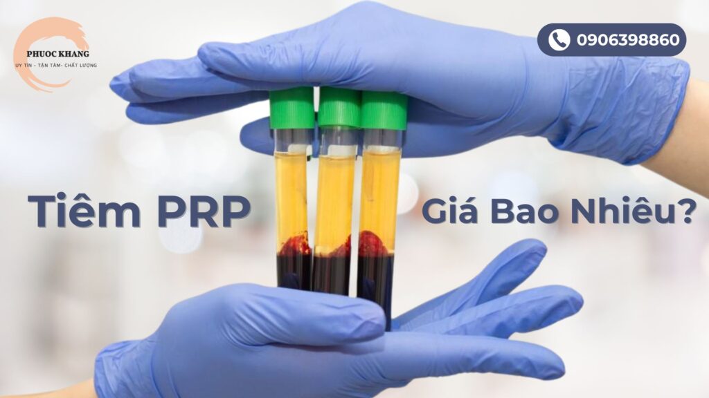 Tiêm PRP giá bao nhiêu?