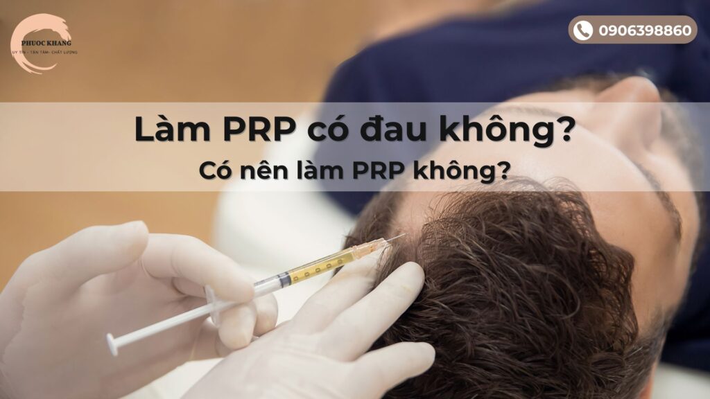 Làm PRP có đau không?