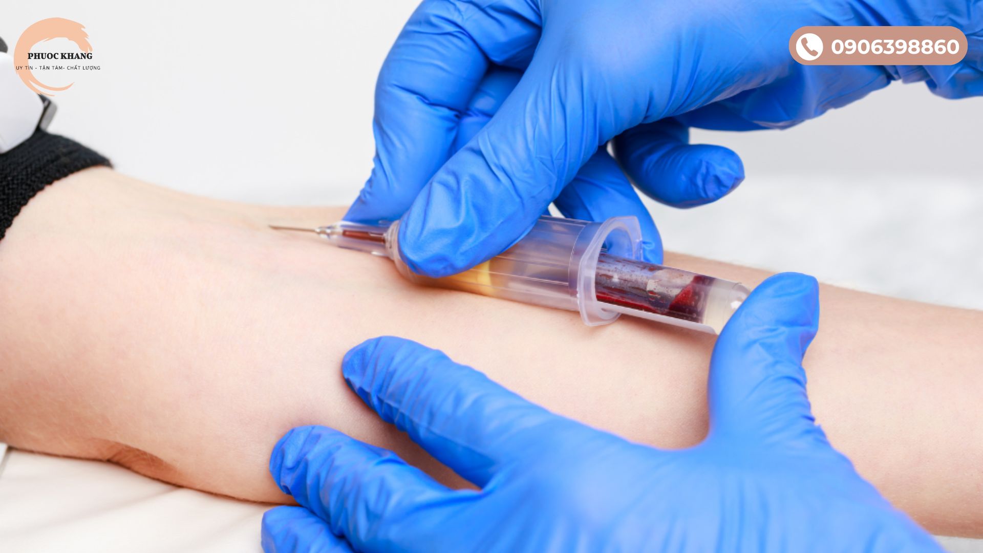 Lấy máu trước khi tiến hành sử dụng PRP