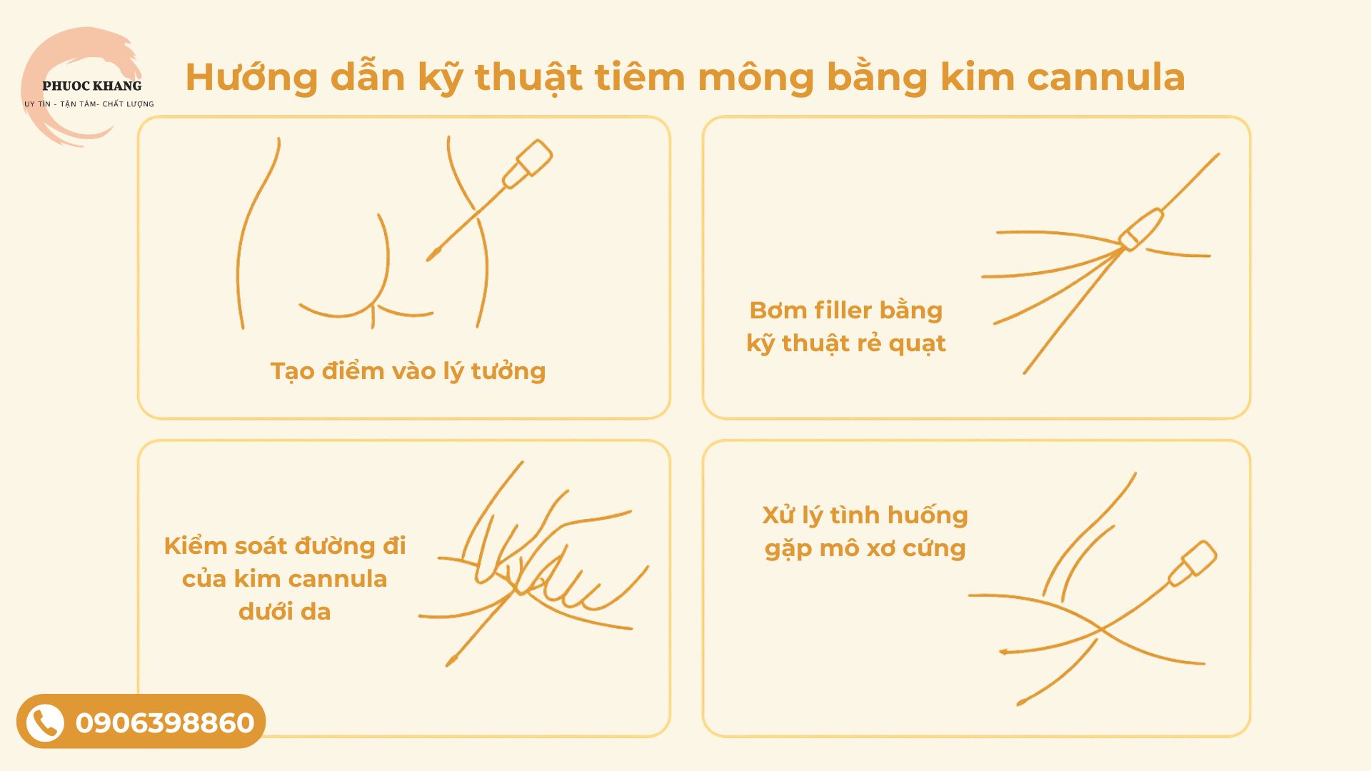 Hướng dẫn sử sụng kim cannula tiêm mông