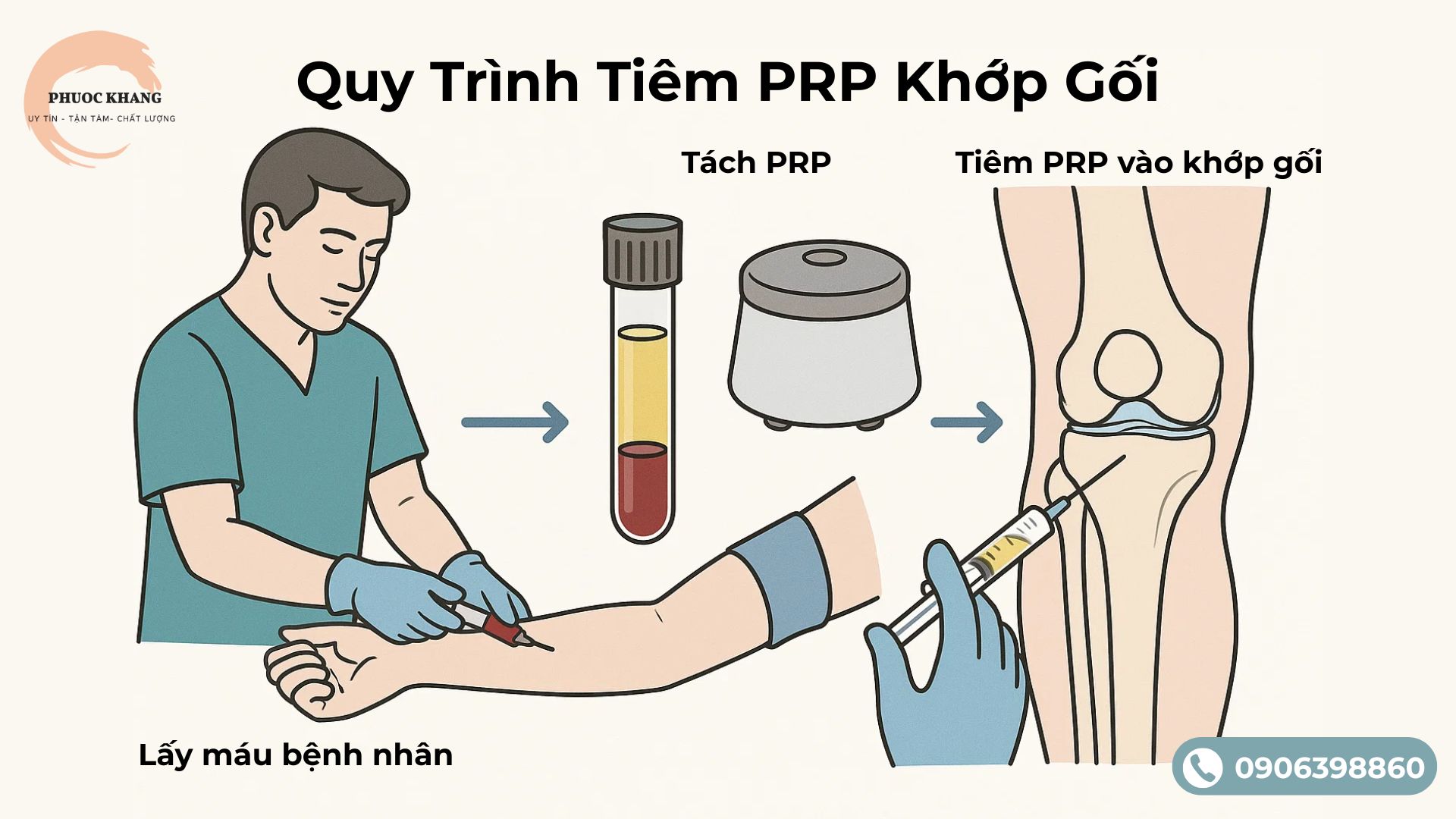 Quy trình tiêm huyết tương giàu tiểu cầu cho xương khớp
