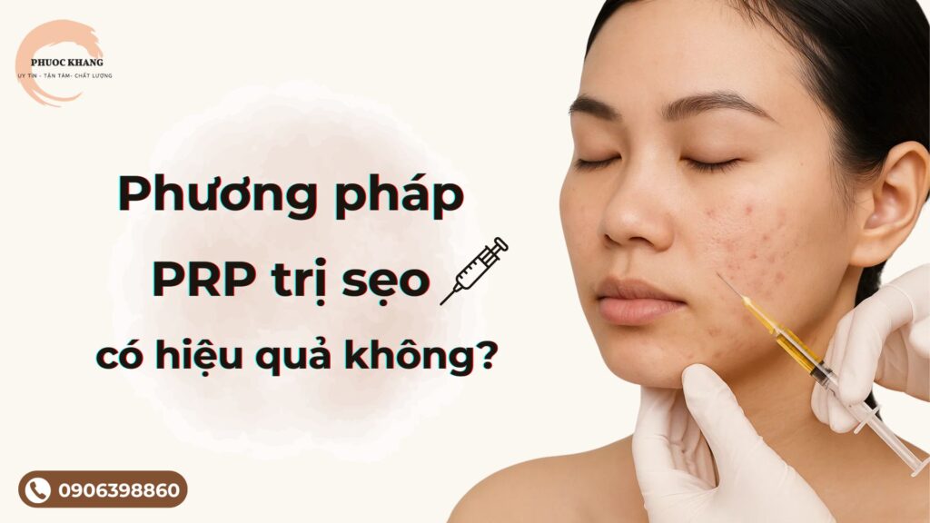 PRP trị sẹo có hiệu quả không?