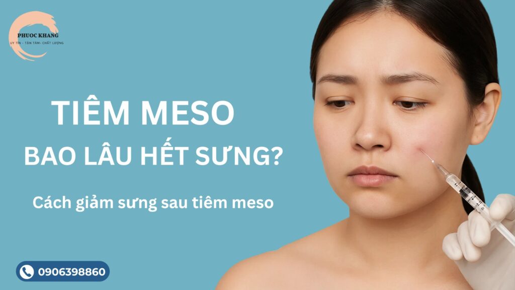 Tiêm Meso bao lâu hết sưng?