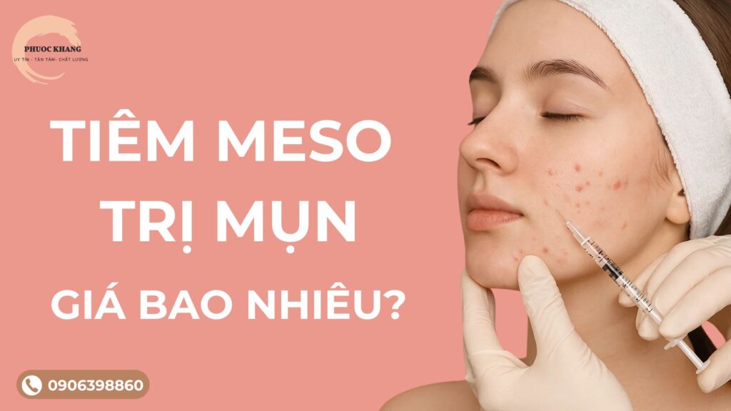 Tiêm meso trị mụn giá bao nhiêu?