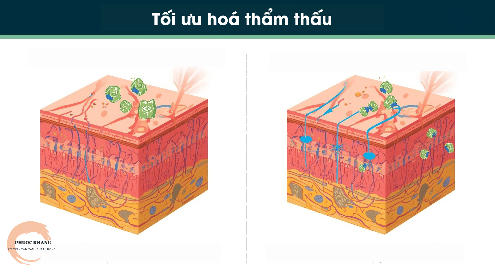 So sánh sự thẩm thấu của mặt nạ nha đam và liệu pháp tối ưu hóa Mesotherapy.